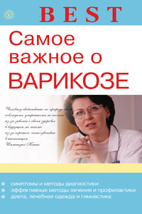 Самое важное о варикозе - Ирина Сергеевна Малышева